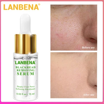 

LANBENA Blackhead Removing Serum Deep Removal Acne Treatment Pores Acne Pimple Gentle Pore Shrink Purifying Skin Care15ml