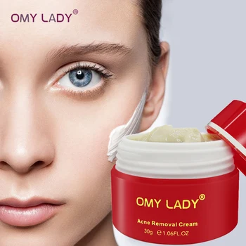 

OMY LADY 100% Plant Serum Acne Treatment Gel Acne Cleaning Face Cream Blackhead Remover Acne Spots Acne Scars Repair Comedone