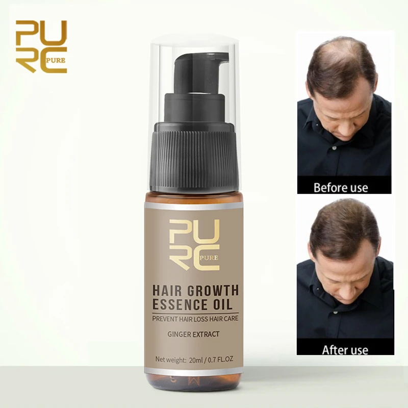 Good Value Essence-Oil Hair-Loss-Treatment Hair-Growth PURC Natural Fast Help for Ingredients-Repair 1zWzWaAqy