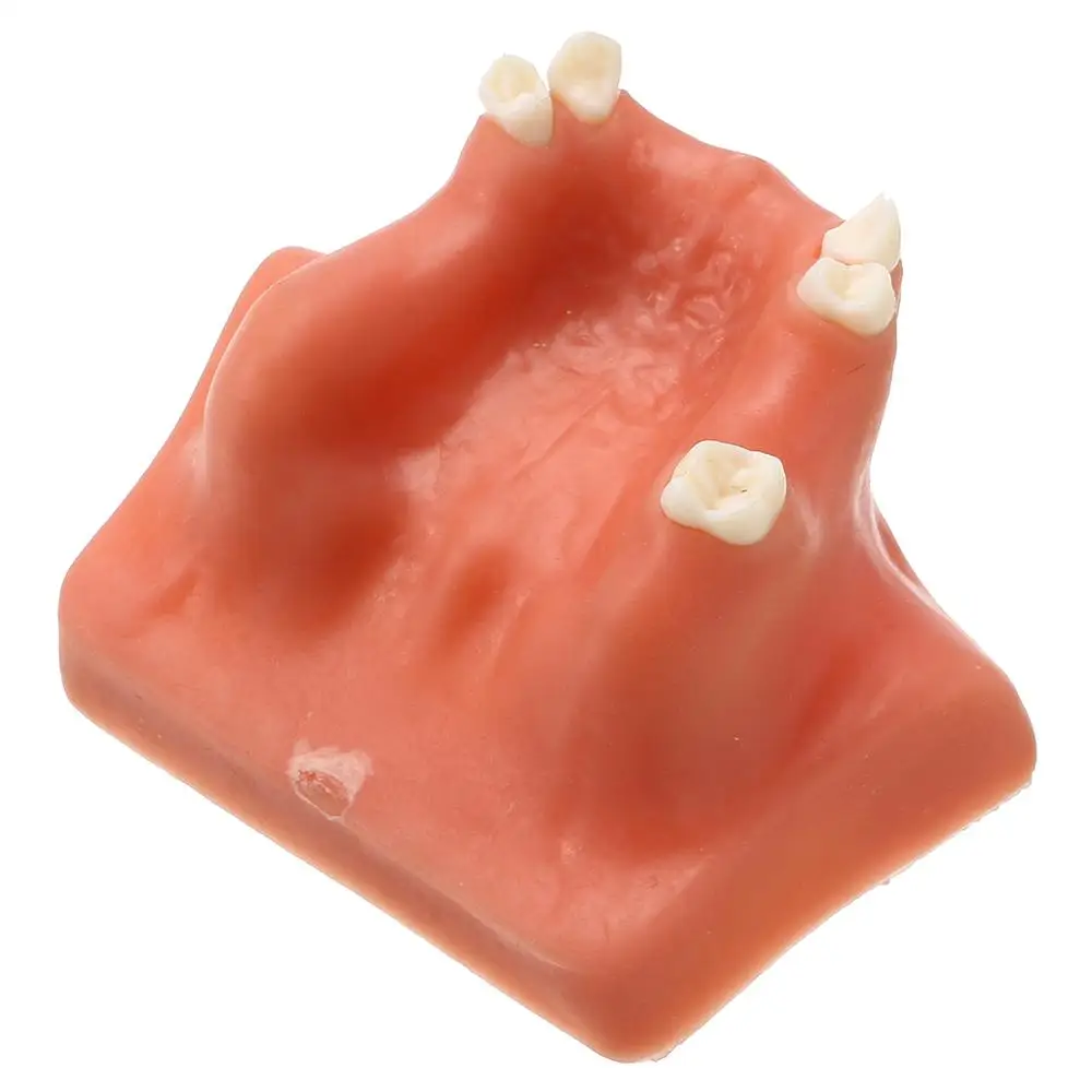 

Resin Maxillary Teeth Model Upper Jaw Sinus Lift Implants Restoration Dental Practice Model For Medical Teach Study Demostration