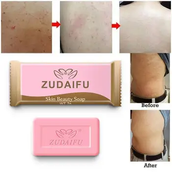 

1PC Mite Pimple Pore Acne Cleaning Soap Deep Cleaning Brighten Skin Soap Remove Blackhead&Oil Control Washing Bath Soap TSLM2