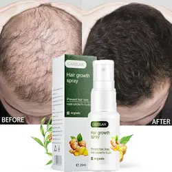 Produtos de crescimento do cabelo óleo de spray de gengibre para o tratamento da perda de cabelo evitar o desbaste do cabelo seco frisado reparação soro cuidados beleza saúde