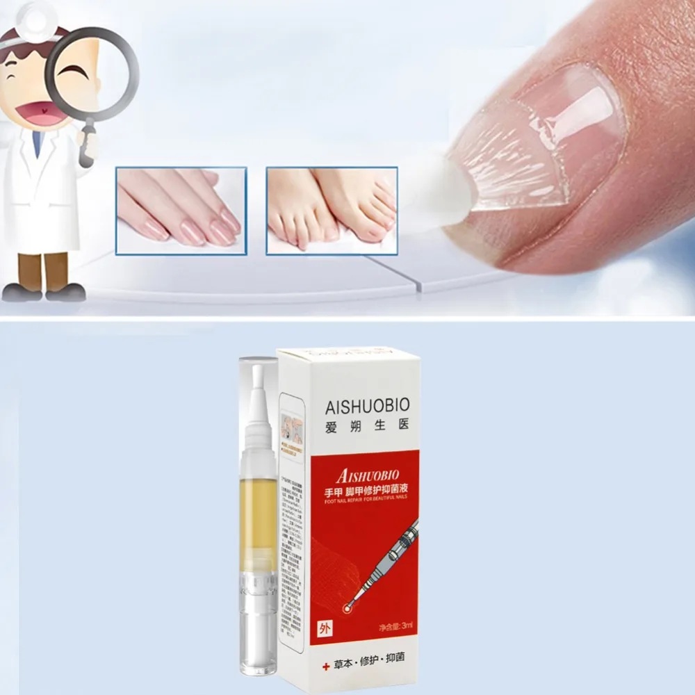 3 мл полезный Onychomycosis ремонт лечение ногтей от грибка эссенция для ногтей и ухода за ногами отбеливающий носок противогрибковый