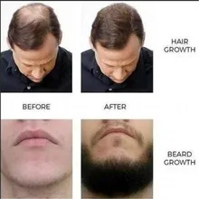 Дропшиппинг мужское масло для роста бороды волосы для ресниц и бровей усилитель роста грудь Толстая эссенция выпадение волос лечение мужчин t кондиционеры# ZE