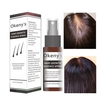 

Okeny's Hair Growth Essence Spray Growth Oil Preventing Baldness Anti Hair Loss Hair Care Nourishing Enhancing Hair Roots.w