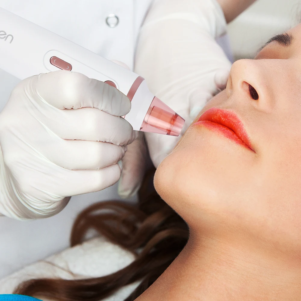 Вакуумный отсос угрей для удаления глубоких пор лица Очиститель носа угрей Удаление прыщей уход за кожей Инструменты беспроводной зарядки база