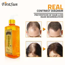 Профессиональный имбирный шампунь для волос 300 мл, густой, шампунь против выпадения волос, восстанавливающий продукт, питающий упругой