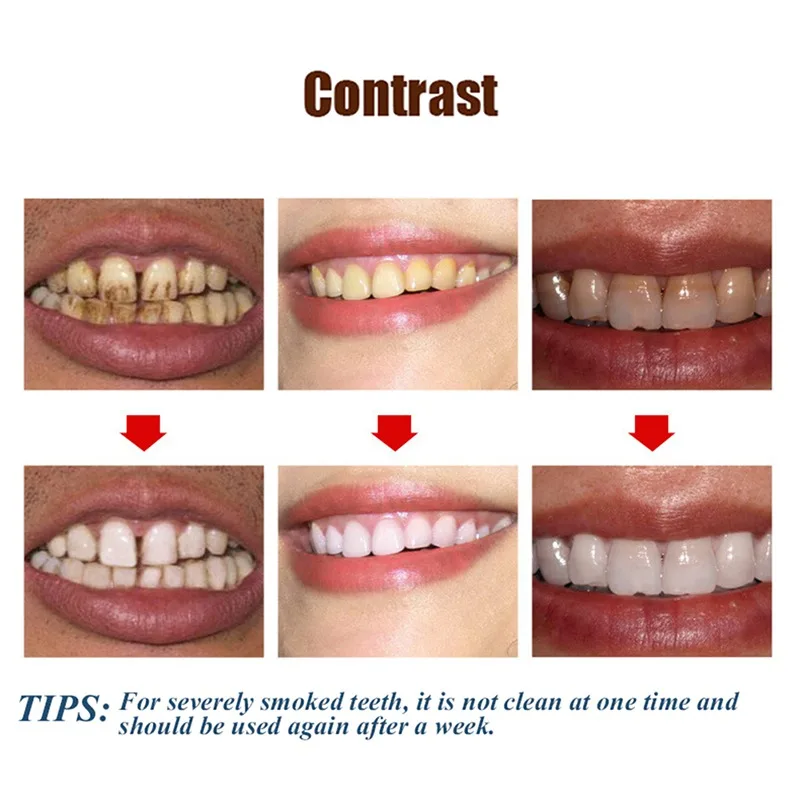 Чистящий порошок сыворотка отбеливание зубов эссенция продукт улыбка зуб