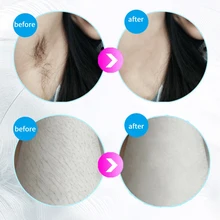 Хит! IPL система удаления волос для женщин, постоянное безболезненное обновление до 600000 вспышек, устройство для профессионального удаления волос на лице