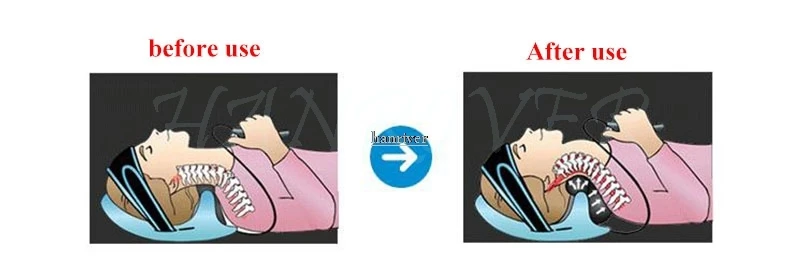 HTB1.JToOVXXXXbHaXXXq6xXFXXXB