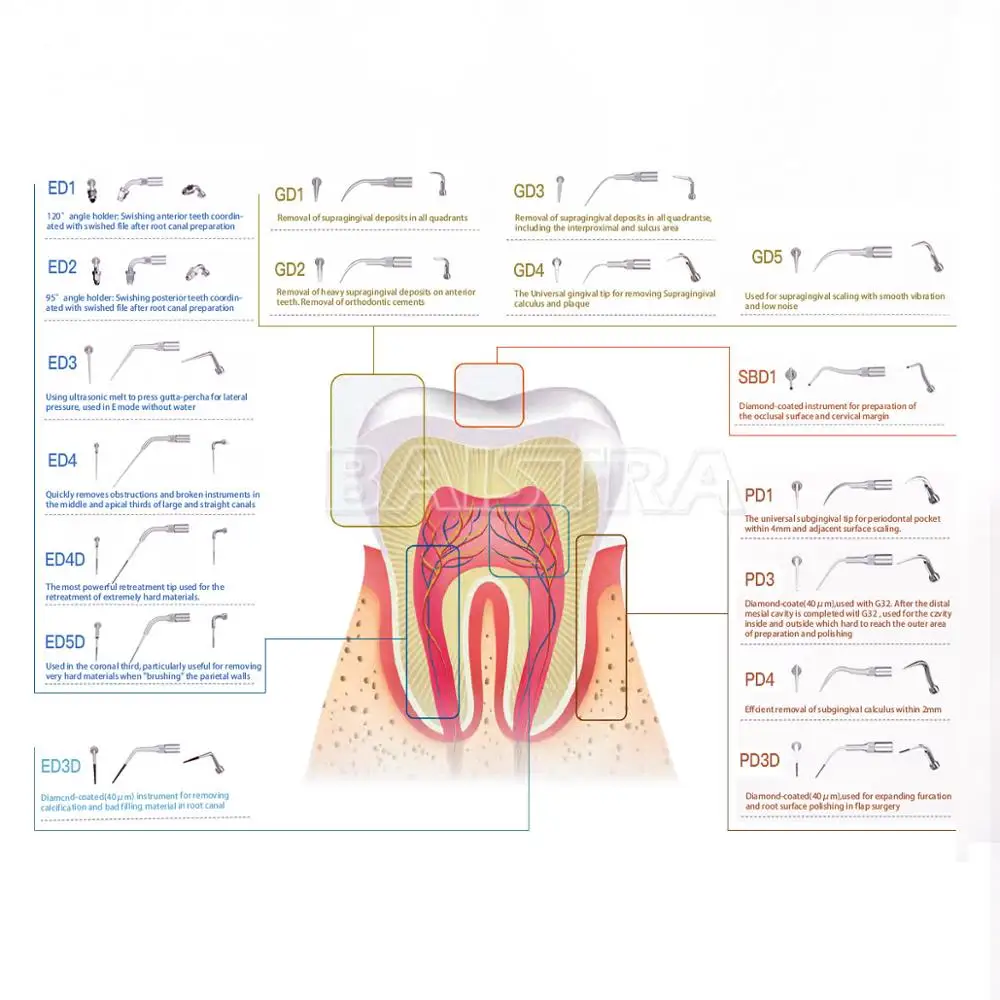 AZDENT 5 pz/pacco Dental Ultrasonic Scaler Tip Scaling parodontics endodonzia adatta per SATELEC DTE NSK ablatori ad ultrasuoni
