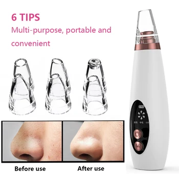 

Skin Care Acne Pore Cleaner Blackhead Remover Face Pore Vacuum Pimple Removal Vacuum Suction Facial Tool Clean Machine USB