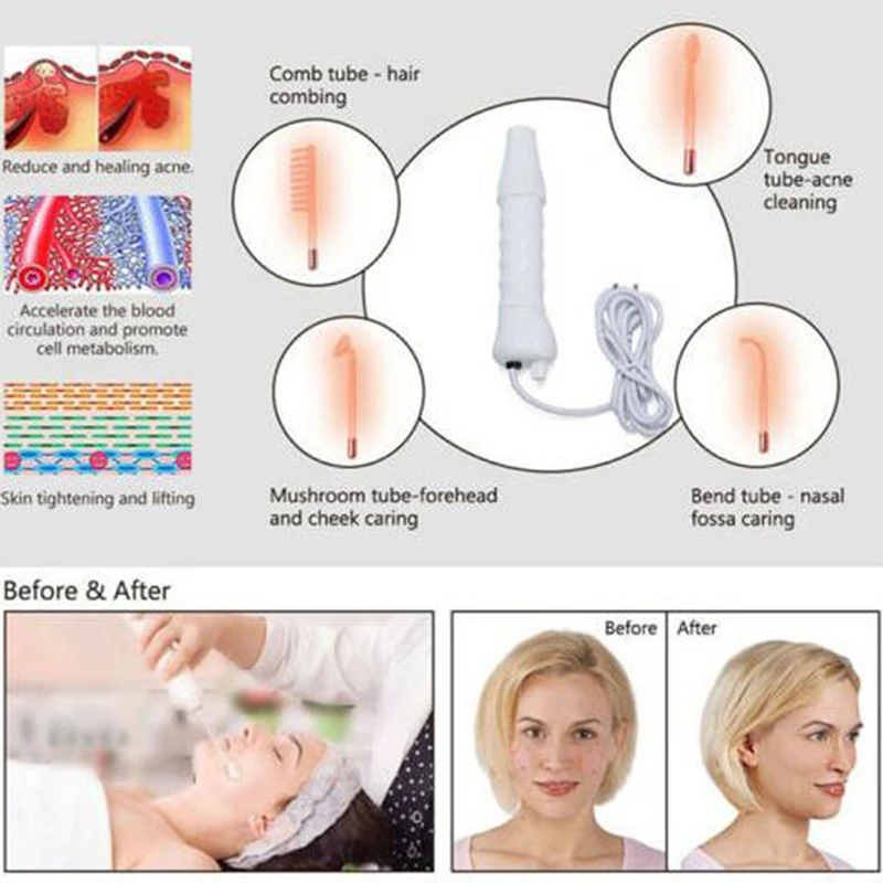 Portable High Frequency Skin Tightening Acne Spots Wrinkles Removal Anti Age Facial Machine With 4pcs Replacement Heads