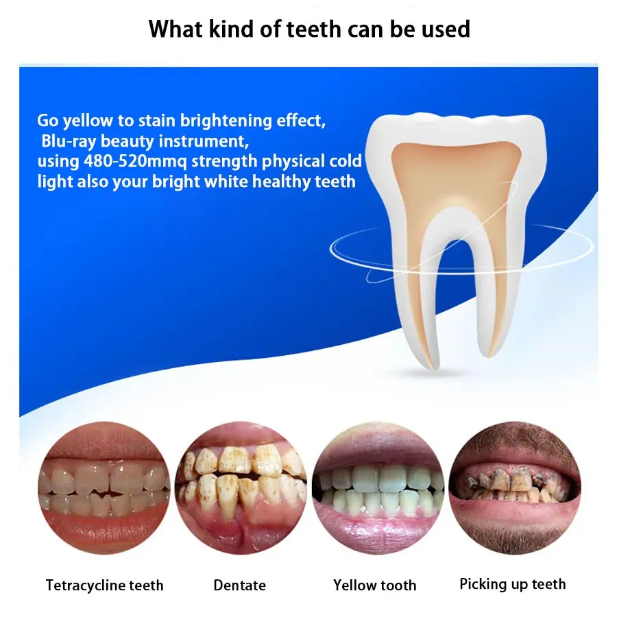 Teeth Whitening Dental LED Light Professional White Teeth Kit Device 3 USB Ports Gum Beauty Health 4