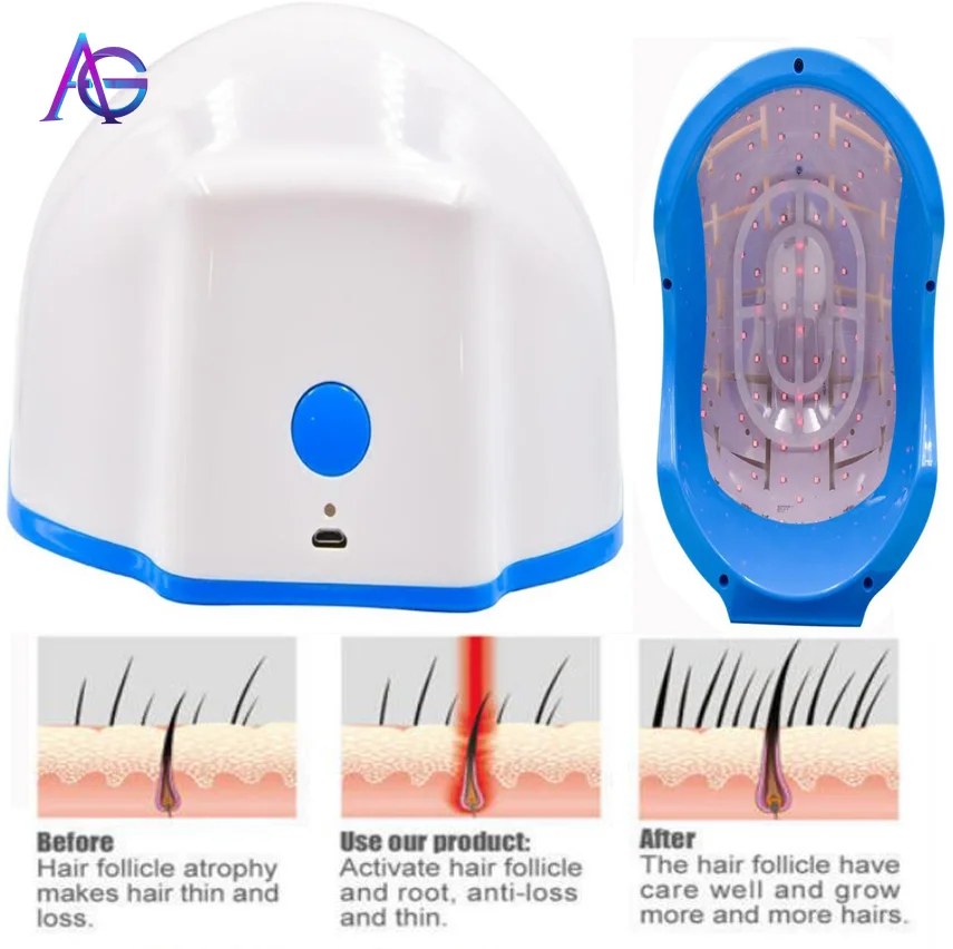  New Portable LED Anti-hair loss Hair growth HELMET - 4000120201039