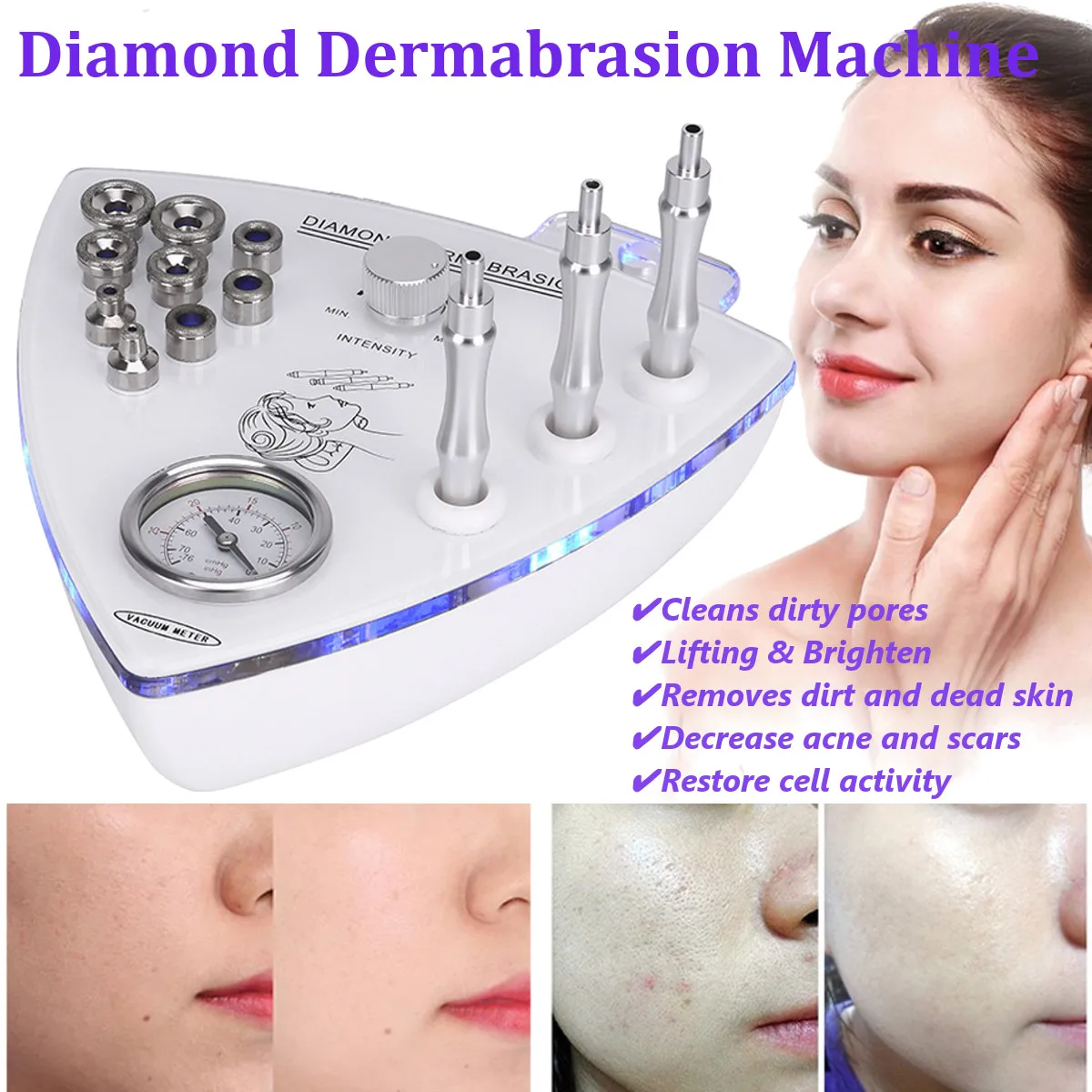

1Pc Beauty Star Diamond Microdermabrasion Dermabrasion Machine With Spray Water Spray Vacuum Suction Exfoliation Facial Massage