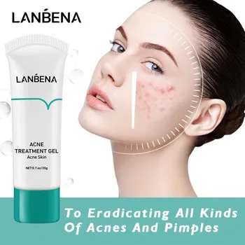 

LANBENA Acne Treatment Cream Remove Blackhead Pimples Gel Face Clean Effective Fade Marks Scars Refreshing Repair Skin Care 20ml