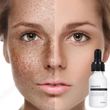 Nicotinamide Face Serum Whitening Hyaluronic Acid Moisturizing Firming Essence Weaken Acne Marks Relieve Dull Skin Care MICAOJI