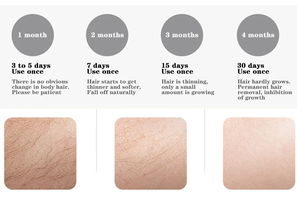 LCD Laser Hair Removal Skin Acne Household Full Body Facial Leg