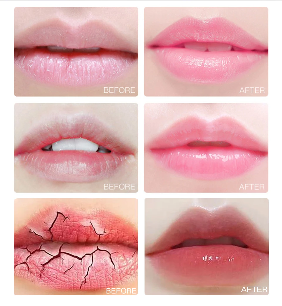 Cherry  Lip Mask Plumper Anti-Drying Repairing Lip Lines Scrub Gel Patch Moisturizing Exfoliating Balm Anti Wrinkle Lips Care