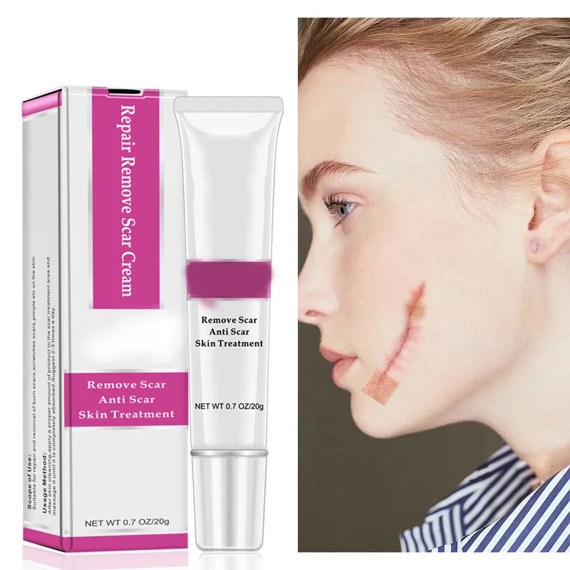 

Acne Scar Stretch Marks Remover Cream Skin Repair Face Cream Acne Spots Acne Treatment Blackhead Whitening Cream Skin Care