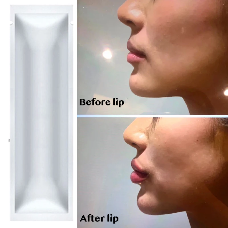 Barato Juvaderm-inyección de llenado de labios, relleno de labios agrandado reticulado, ácido hialurónico, 2ML 33mj6d0ng56 Barato Juvaderm-inyección de llenado de labios, relleno de labios agrandado reticulado, ácido hialurónico, 2ML 33mj6d0ng56