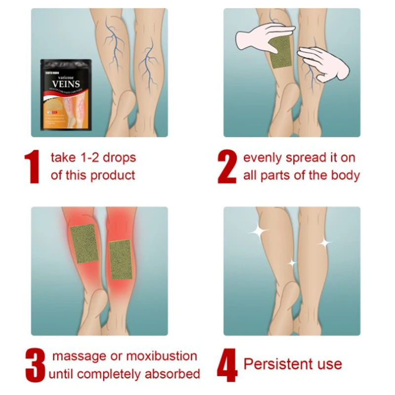 12Pcs/bag Varicose Veins Patch Remove Angiitis Dilated Vasculitis Spider Legs Chinese Medical Plaster Improves Blood Circulation pain relief patch blood sugar patch anti cough plaster urine leakage patch