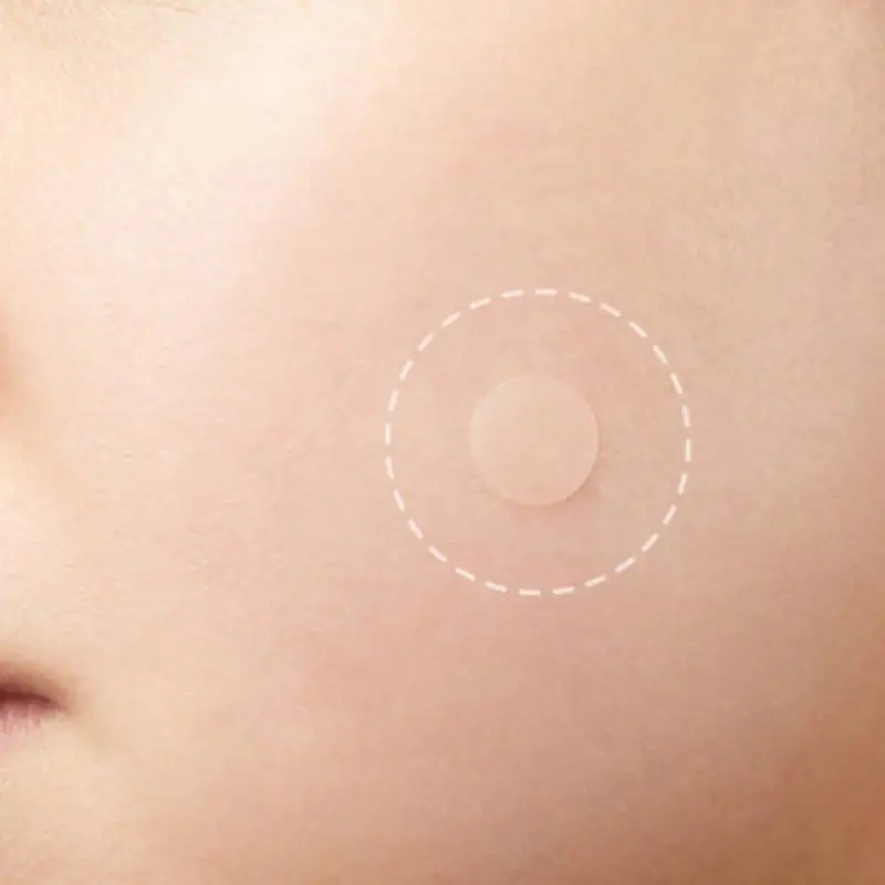 36pcs Hydrocolloid Acne Invisible Pimple Master Patch Acne Patch Set Treatment Acne Stickers Acne Remover Facial Care Tool TSLM1