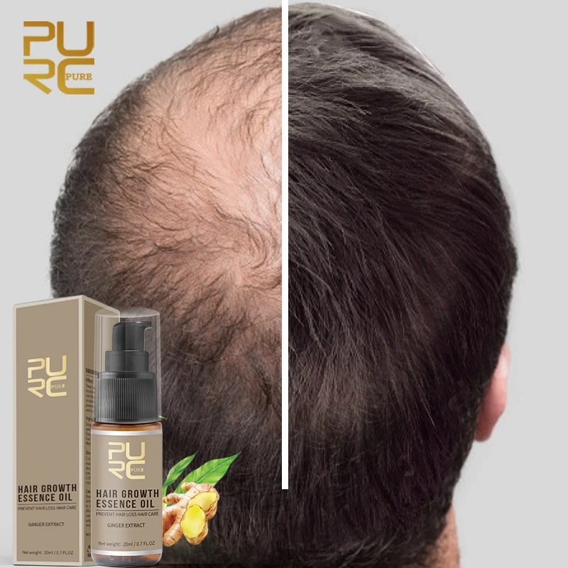 

PURC Ginger Hair Growth Oil Fast Hair Growth Products Prevent Hair Loss Thinning Scalp Treatment for Men and Women