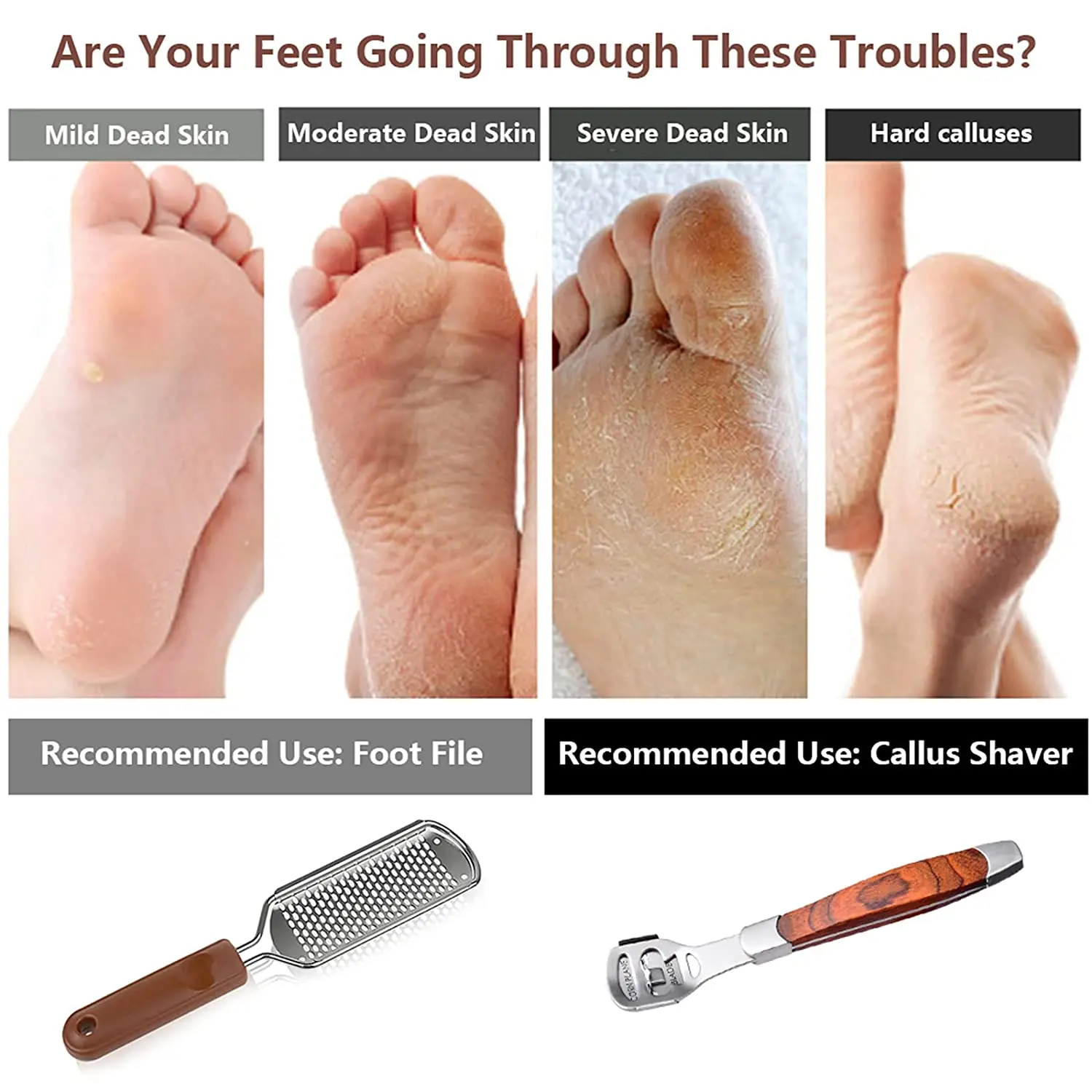 Callus Shaver Set Stainless Steel Foot Dead Skin Removal (Rose