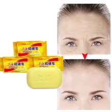 Горячая 1 шт Серного мыла для ремонта без акне, псориаза, себорейной eczema, антибактериальное мыло для ванны и отбеливания