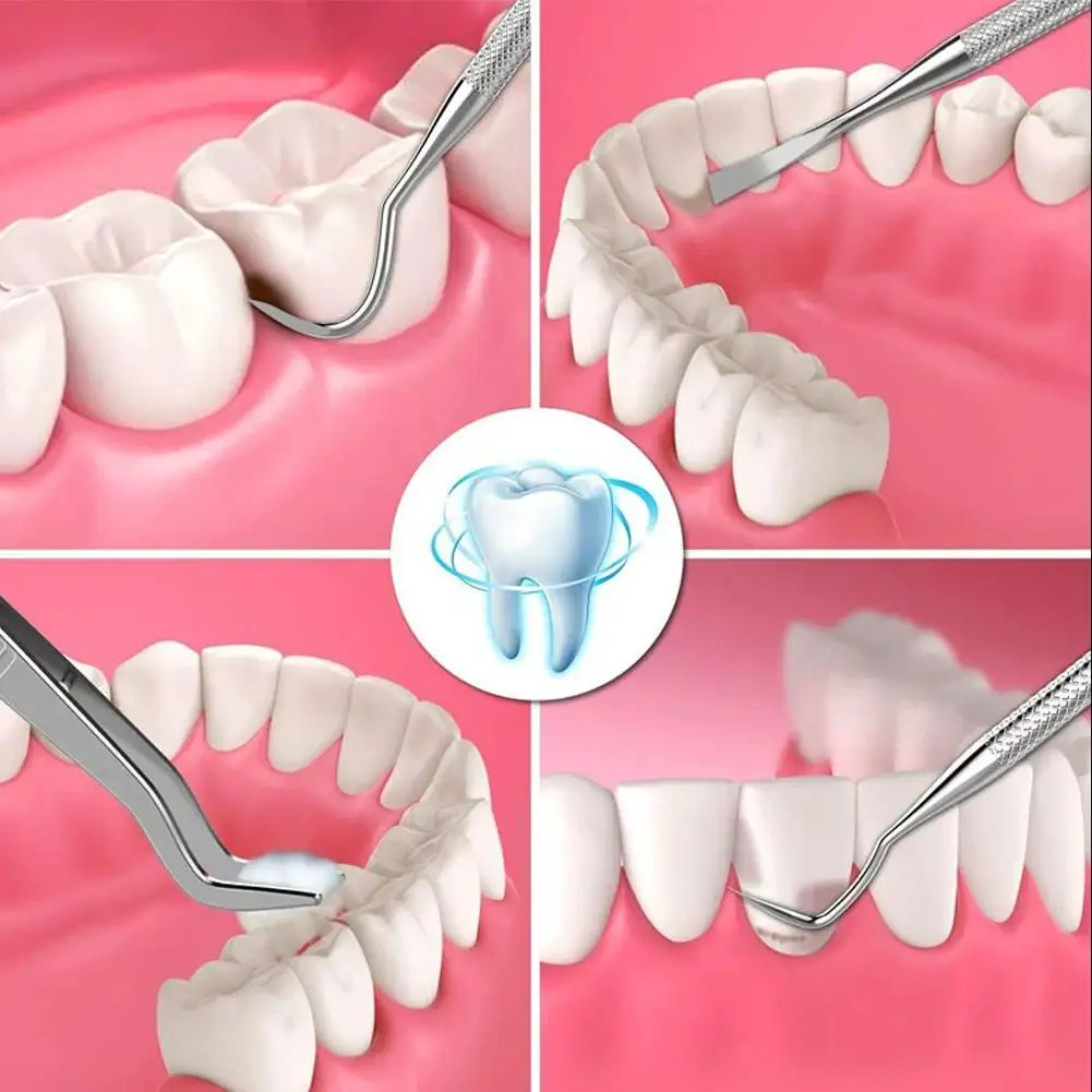 Gel Enzymatique Dissolvant De Carie Dentaire BRIX - 3g - Livraison Gratuite - Neuf Sous Blister