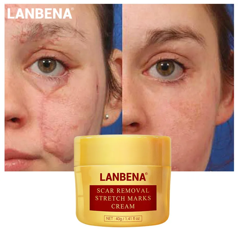 

LANBENA Scar Remove Cream Face Moisturizing Cream Anti Wrinkle Anti Aging Face Fine Lines Acne Treatment Skin Care 40g