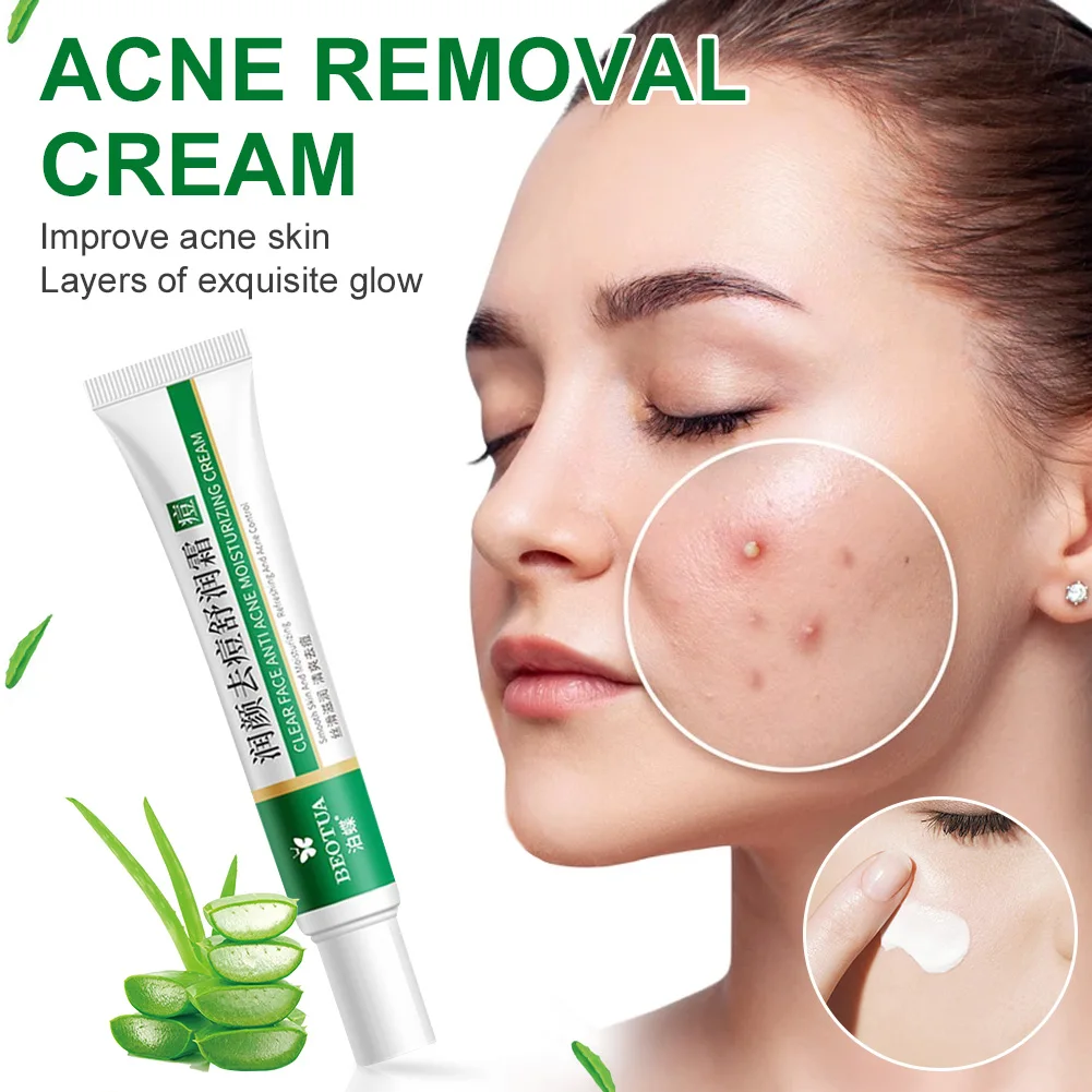 

Effective Acne Removal Cream Herbal Acne Spots Oil Control Acne Cream Skin Care Whitening Moisturizing Face Gel Skin Care 20g