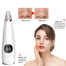 Beurha средство для удаления черных точек для лица Очиститель глубоких пор Удаление прыщей вакуумное всасывание для лица спа алмазный инструмент для ухода за кожей