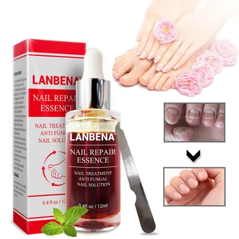 

LANBENA Fungal Nail Treatment Onychomycosis Paronychia Anti Fungal Nail Infection Nail Repair Serum Feet Care Nail Repair Gel