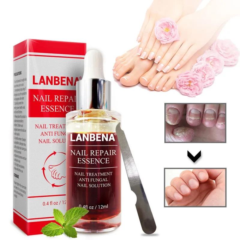 

LANBENA Nail Treatment Cuticle Oil Bright Fungal Nails Repair Onychomycosis Removal Naill Oil Foot Care Anti Infection Nail Care