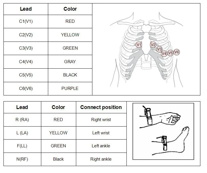 Замена кабеля EKG 10-lead для Esaote Archimed 4120, personal C1, personal C3