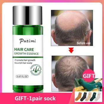 

Fast Growing Hair Growth Serum Natural Ginger Extract Nourishing Damaged Prevent Baldness Hair Serum Anti Hair Loss Products
