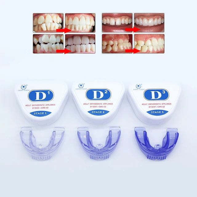 Brackets dentales Protector bucal deportivo Jóvenes Hombres