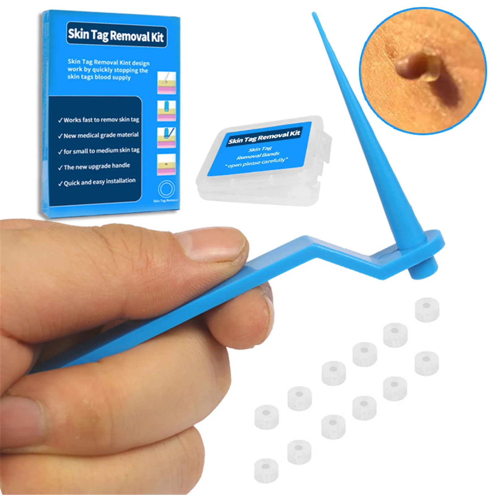 Remove kit. Набор для имплантации neobiotech. Набор для удаления имплантатов fixture remover kit. Implant screw removal kit. Screw remover kit.