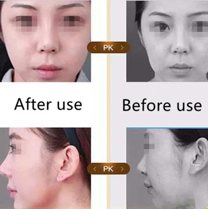 nose shaper (7).jpg_.webp