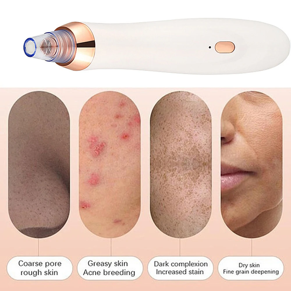 5cebb0b79795ee4c26f2d07d-4-large