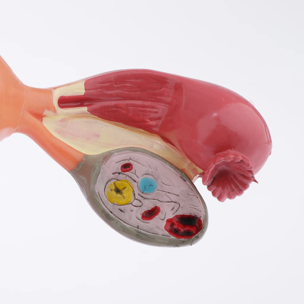 Human Female Uterus Ovary Anatomical Model With Pathologies, 1:1 Life Size, Lab Supplies Decoration