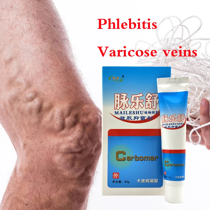 Крем против варикозного расширения вен удаление вены натуральное лечение для