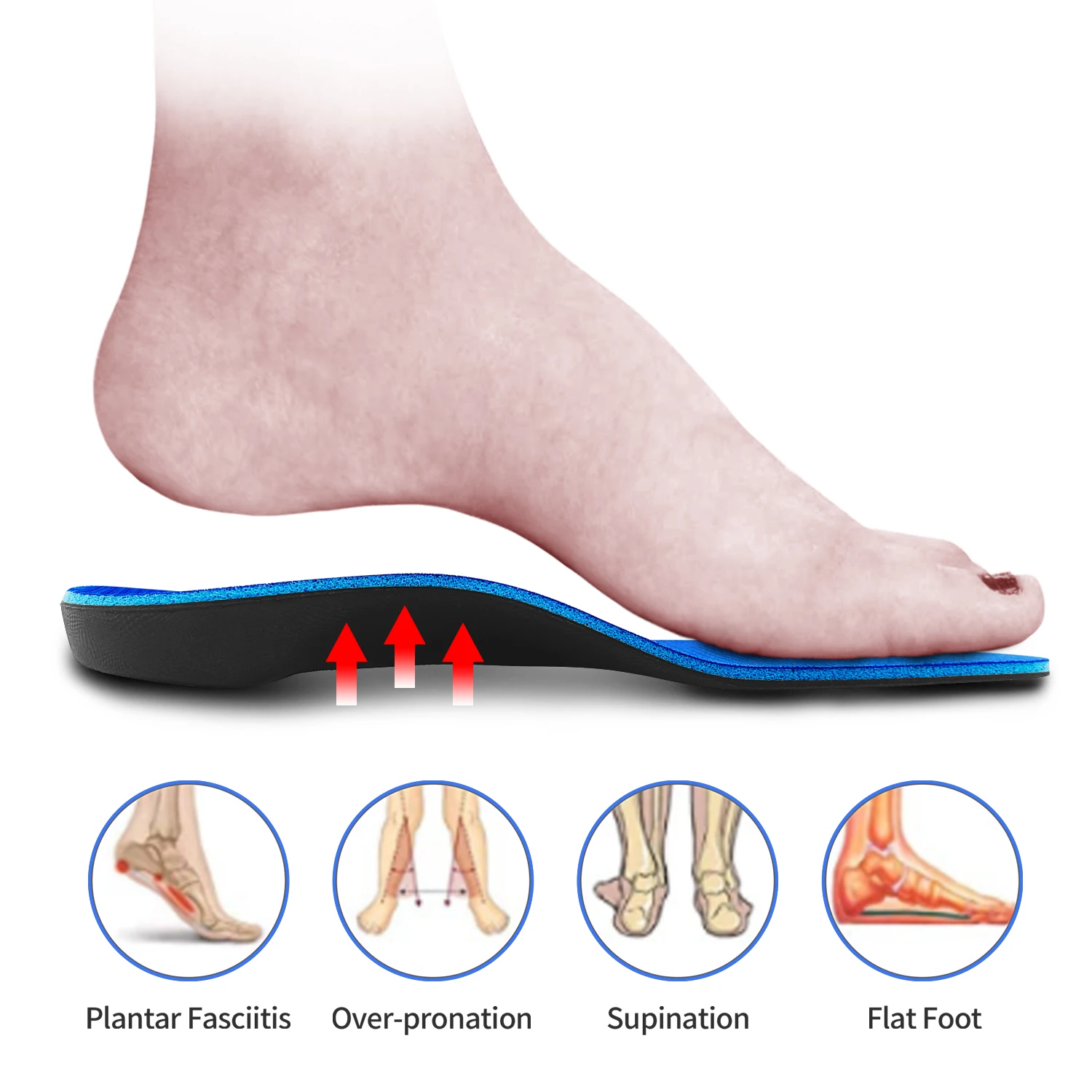 Pronation High Arch