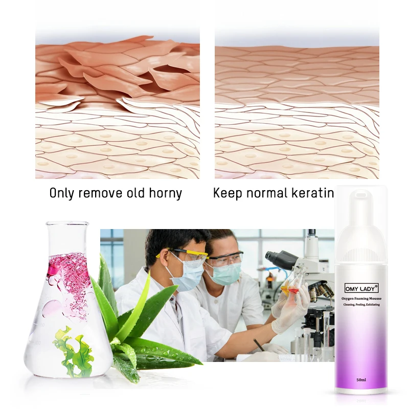 blackhead removal foam