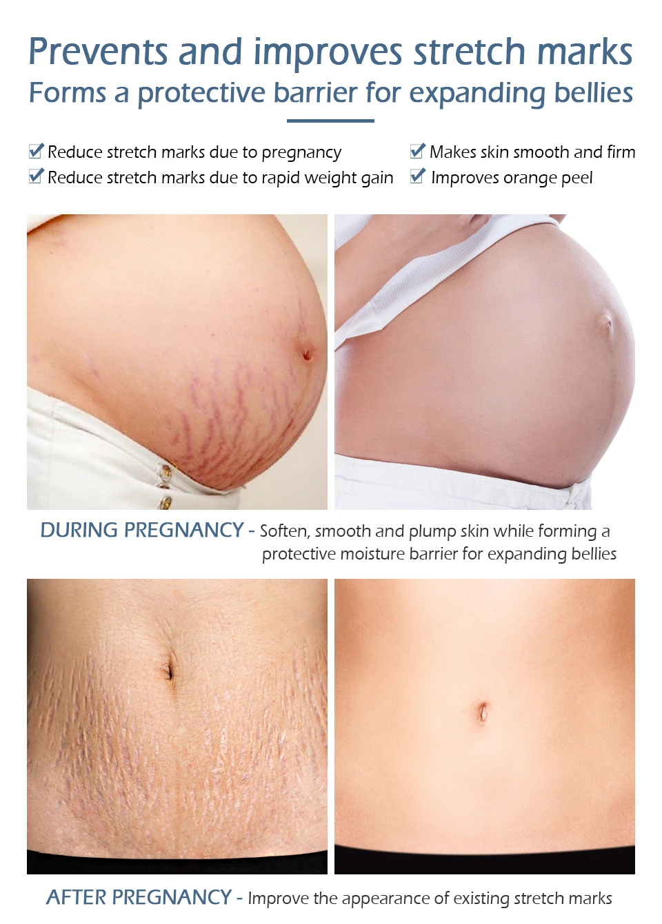 centella stretch marks