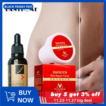 

Lavender Extract Pregnancy Stretch Mark/Scar Repair Essence Remover Oil Postpartum Care Maternity Body Smooth Skin Repair Cream
