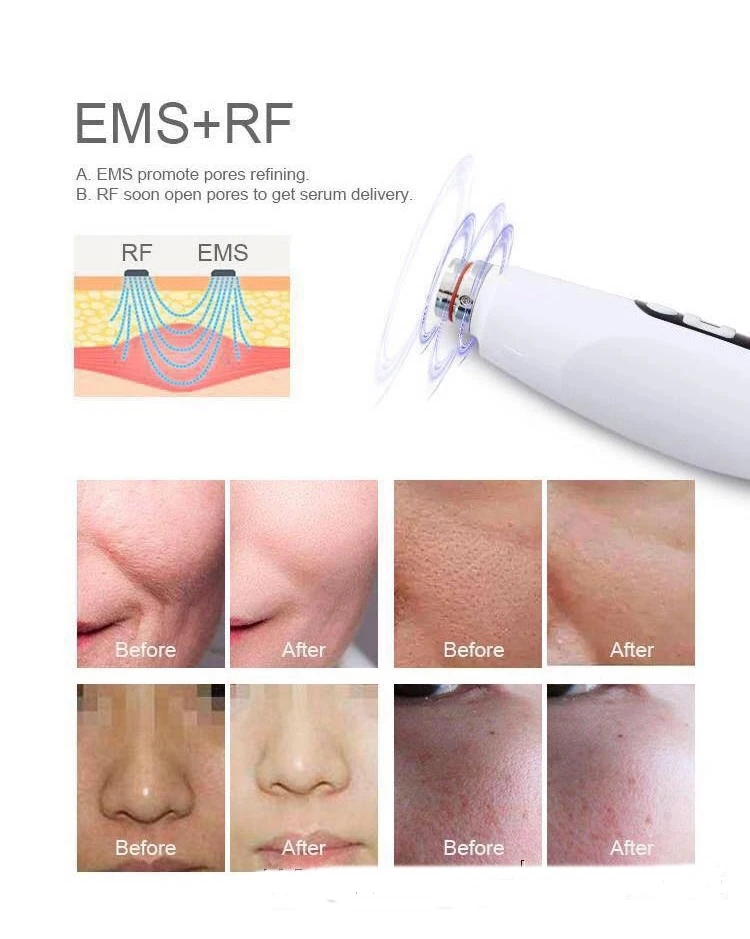 Мезотерапевтический пистолет dr meso для омоложения кожи с микронеедле rf BIO